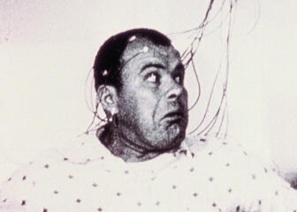 Zwart-wit foto van man met electroden op het hoofd